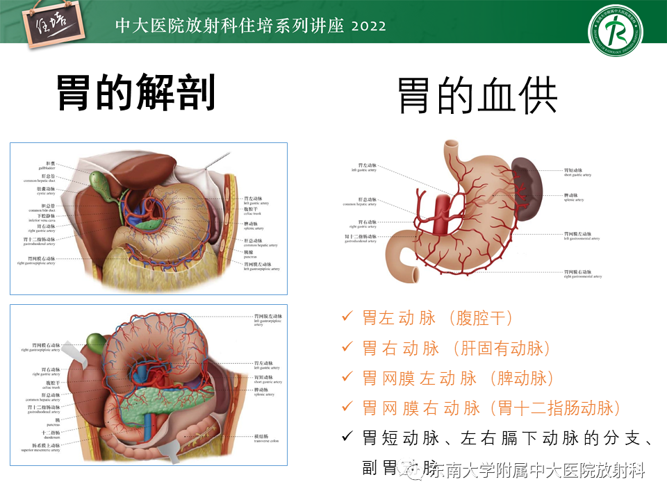 影像PPT - 【PPT】常见胃部急症的影像学征象分析-4