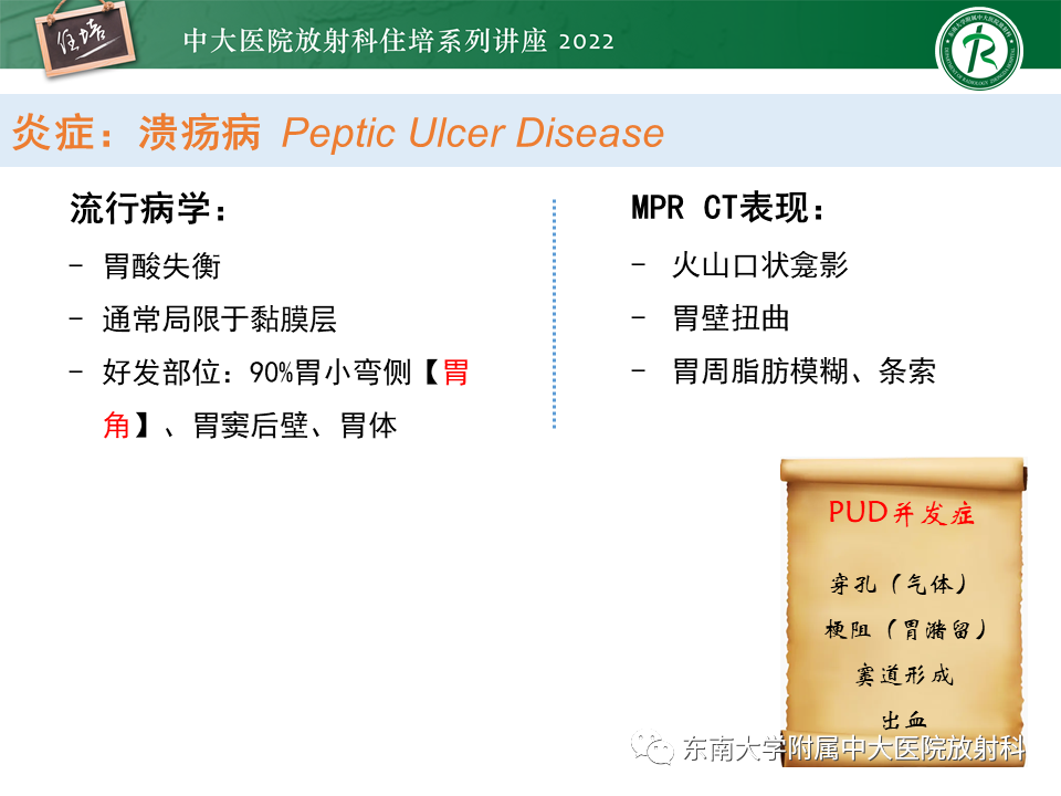 影像PPT - 【PPT】常见胃部急症的影像学征象分析-10