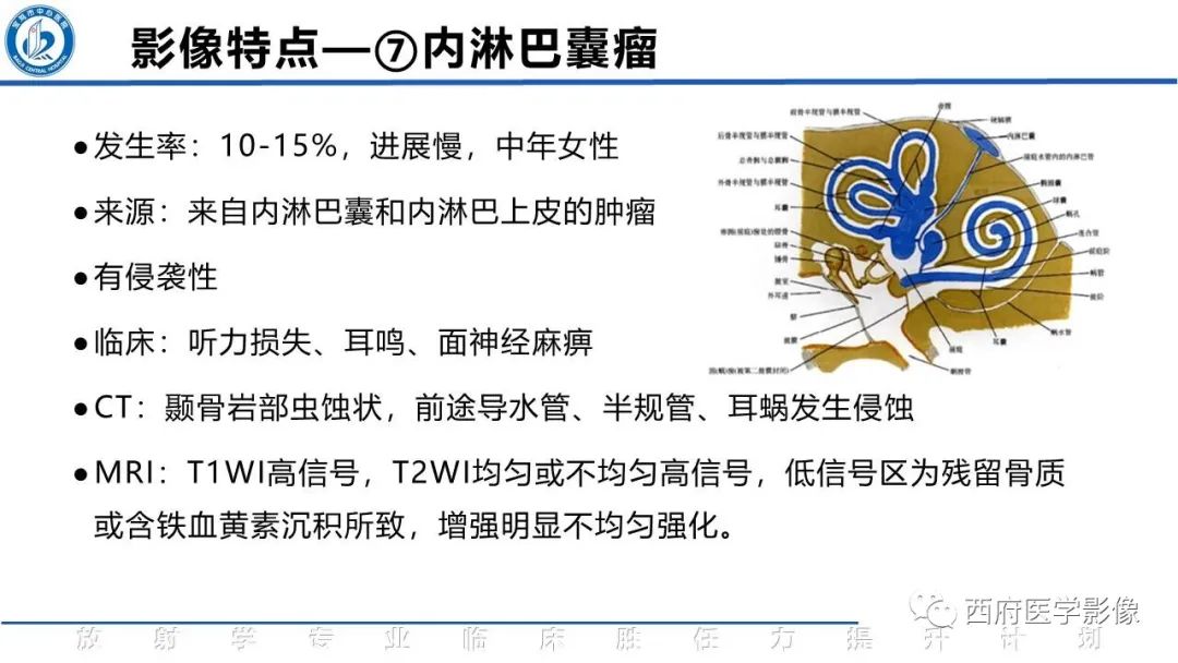 影像PPT - 【PPT】VHL综合征影像诊断-19