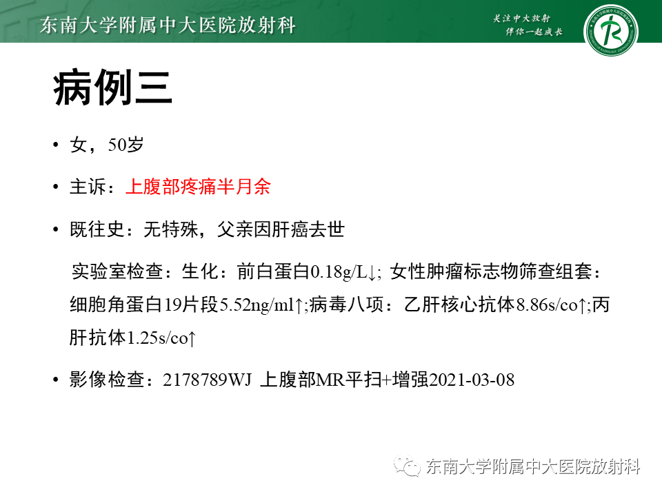 影像PPT - 【PPT】肝黏液性囊性肿瘤(MCN)-20