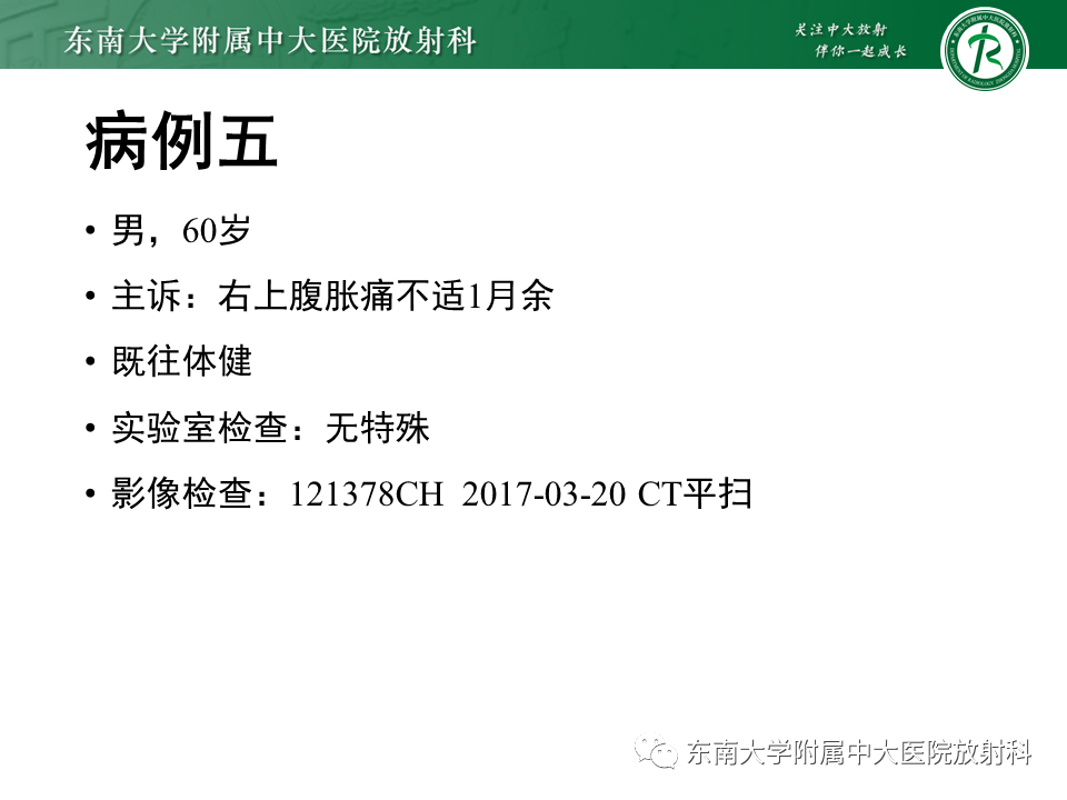 影像PPT - 【PPT】肝黏液性囊性肿瘤(MCN)-31