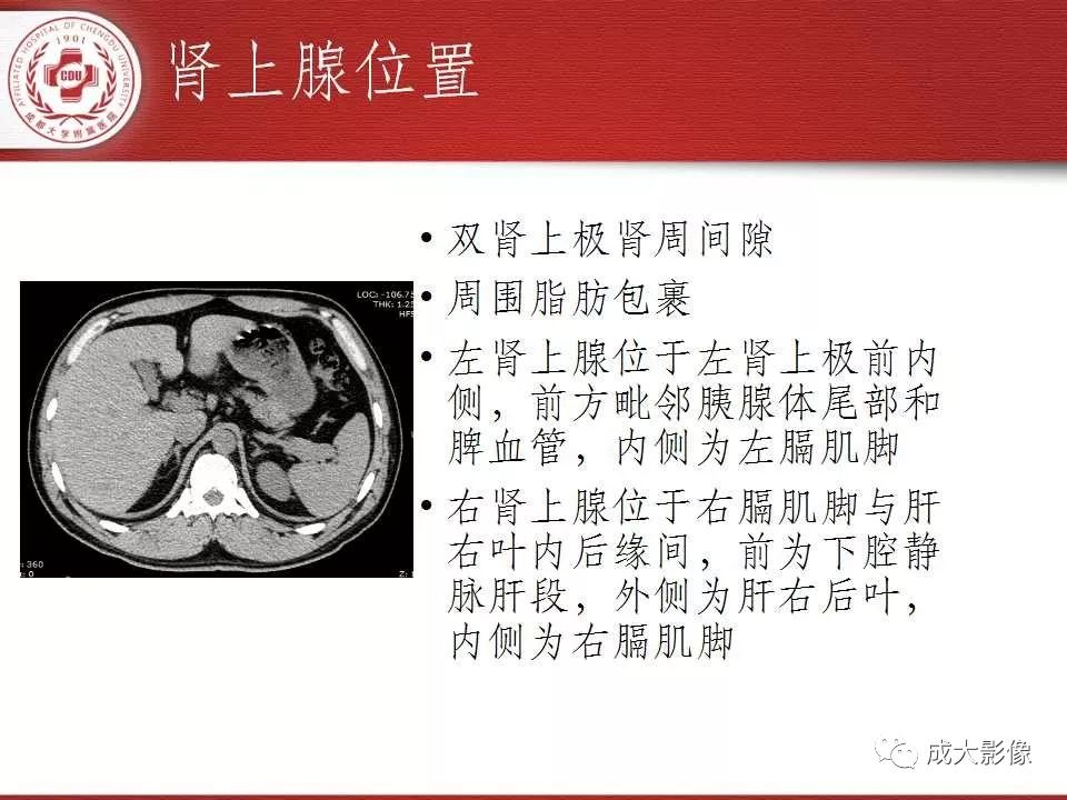 影像PPT - 【PPT】常见肾上腺疾病影像诊断-4