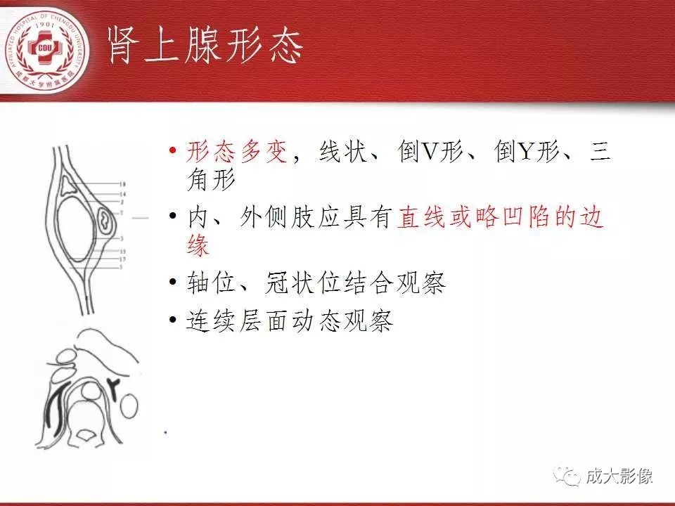 影像PPT - 【PPT】常见肾上腺疾病影像诊断-5