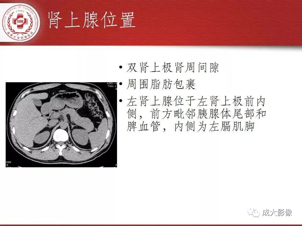 影像PPT - 【PPT】常见肾上腺疾病影像诊断-3