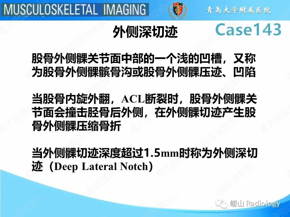 影像PPT - 【PPT】外侧深切迹征（前交叉韧带撕裂）-12