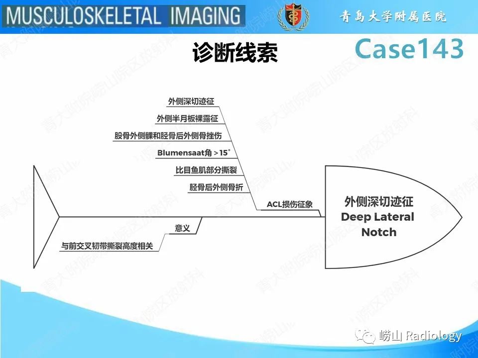 影像PPT - 【PPT】外侧深切迹征（前交叉韧带撕裂）-20