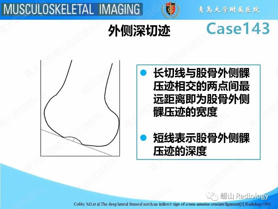 影像PPT - 【PPT】外侧深切迹征（前交叉韧带撕裂）-14