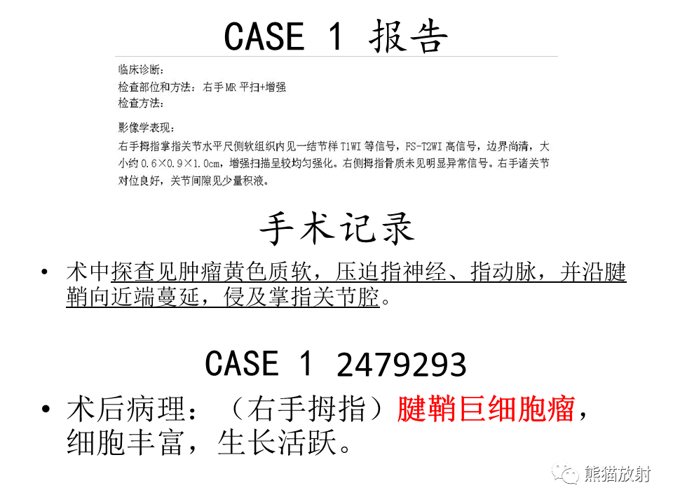影像PPT - 【病例】腱鞘巨细胞瘤2例MR影像-18
