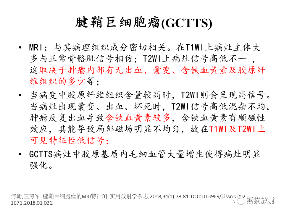 影像PPT - 【病例】腱鞘巨细胞瘤2例MR影像-22