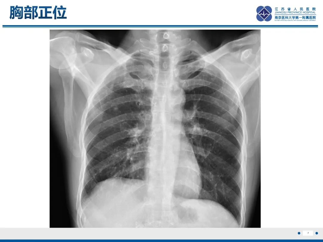 影像PPT - 【PPT】原发性肾上腺皮质功能减退症-8