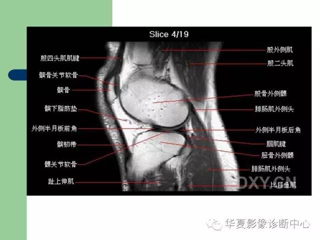 影像PPT - 【PPT】大关节MRI解剖-7