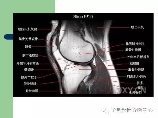 影像PPT - 【PPT】大关节MRI解剖-8