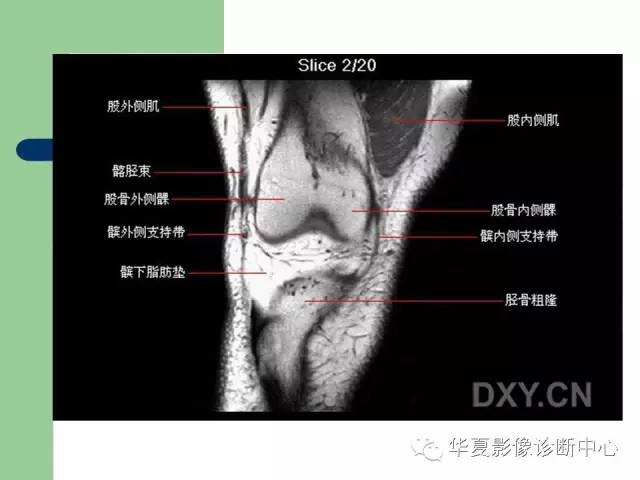 影像PPT - 【PPT】大关节MRI解剖-22