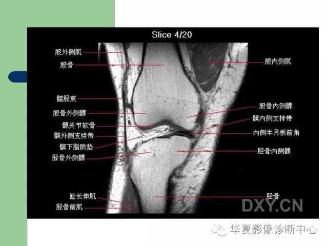 影像PPT - 【PPT】大关节MRI解剖-24