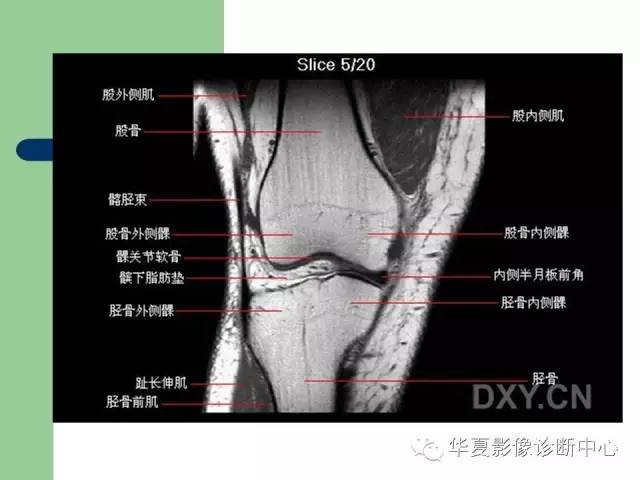 影像PPT - 【PPT】大关节MRI解剖-25