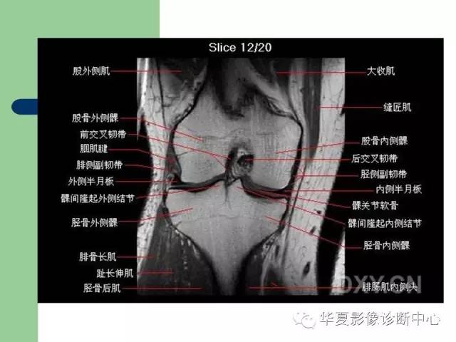 影像PPT - 【PPT】大关节MRI解剖-32
