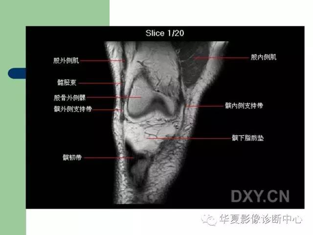 影像PPT - 【PPT】大关节MRI解剖-21