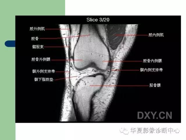 影像PPT - 【PPT】大关节MRI解剖-23