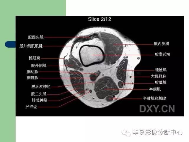 影像PPT - 【PPT】大关节MRI解剖-42