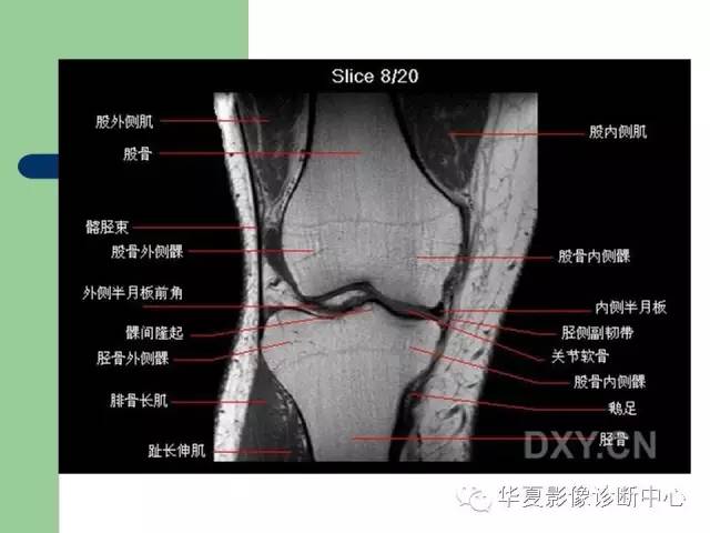 影像PPT - 【PPT】大关节MRI解剖-28