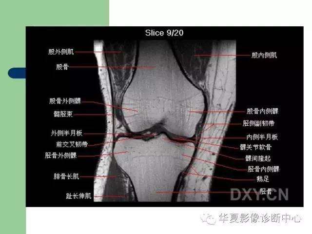 影像PPT - 【PPT】大关节MRI解剖-29