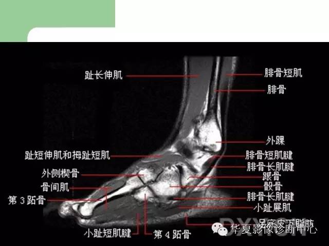 影像PPT - 【PPT】大关节MRI解剖-73
