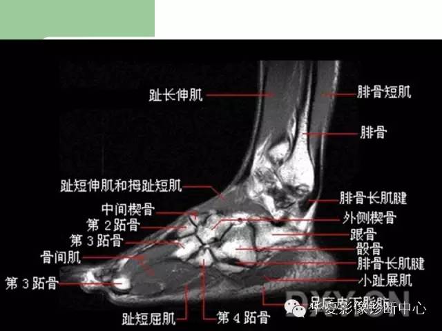 影像PPT - 【PPT】大关节MRI解剖-74