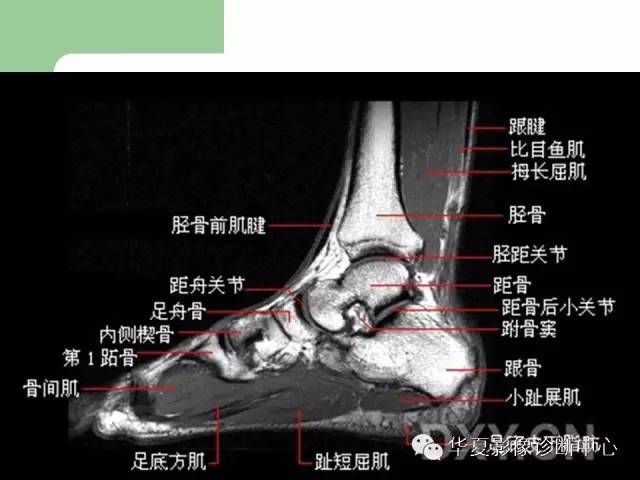 影像PPT - 【PPT】大关节MRI解剖-78