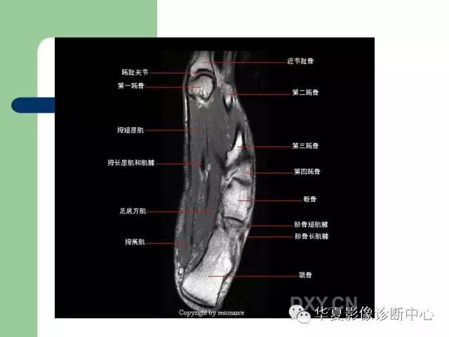 影像PPT - 【PPT】大关节MRI解剖-70