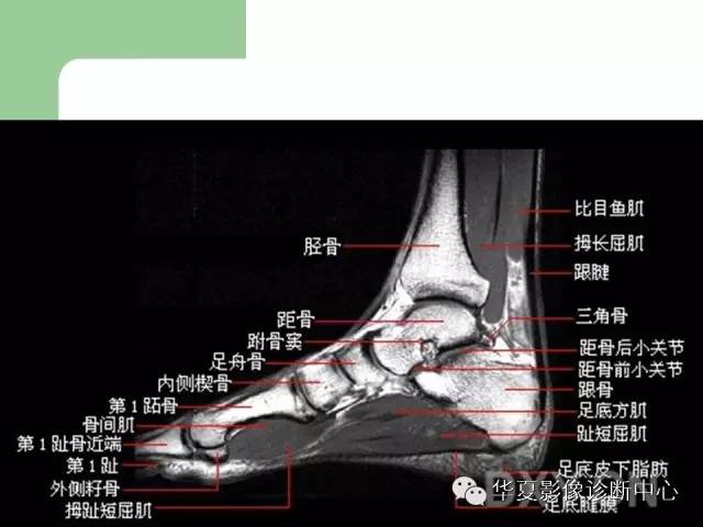 影像PPT - 【PPT】大关节MRI解剖-80