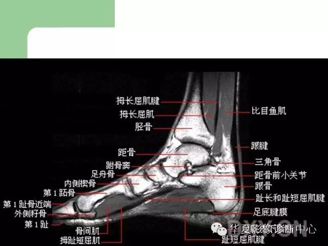 影像PPT - 【PPT】大关节MRI解剖-81