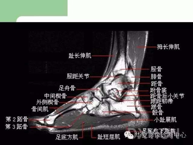 影像PPT - 【PPT】大关节MRI解剖-76
