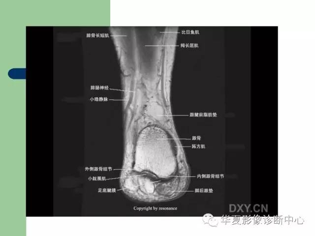 影像PPT - 【PPT】大关节MRI解剖-88