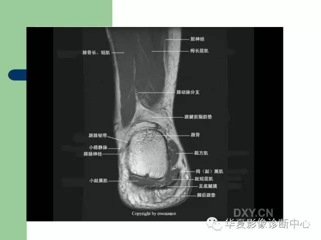 影像PPT - 【PPT】大关节MRI解剖-90