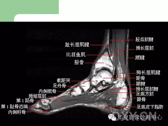 影像PPT - 【PPT】大关节MRI解剖-82