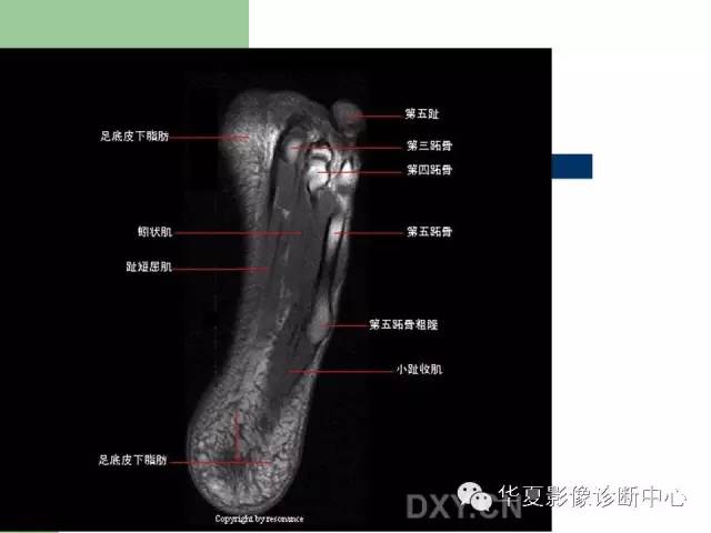 影像PPT - 【PPT】大关节MRI解剖-72