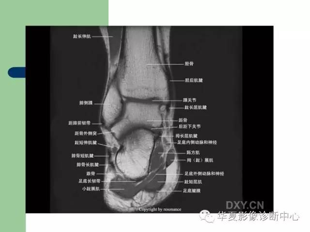 影像PPT - 【PPT】大关节MRI解剖-94