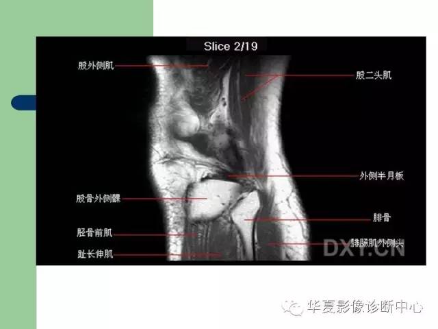 影像PPT - 【PPT】大关节MRI解剖-5