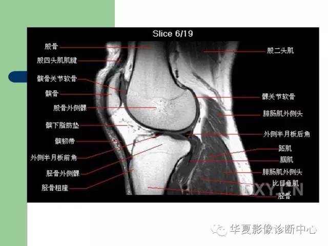 影像PPT - 【PPT】大关节MRI解剖-9