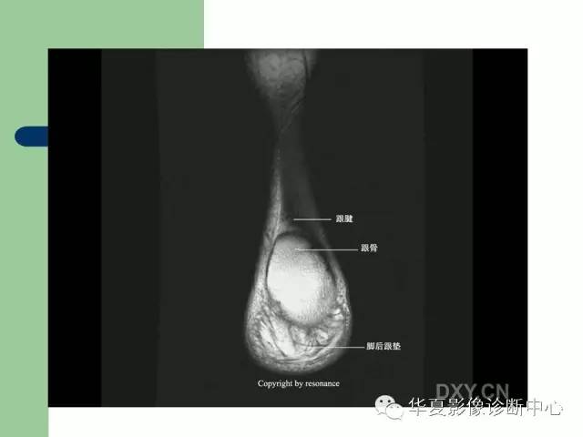 影像PPT - 【PPT】大关节MRI解剖-85