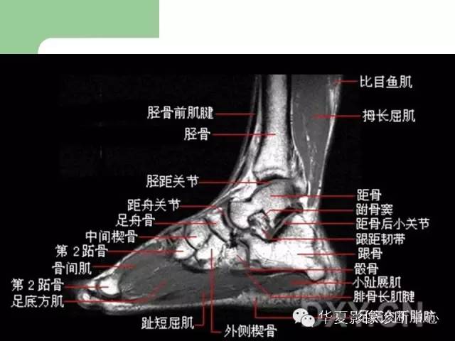 影像PPT - 【PPT】大关节MRI解剖-1