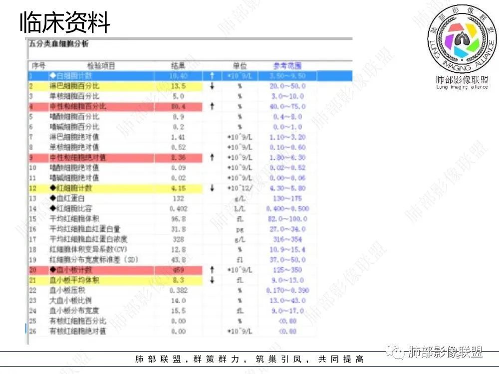 影像PPT - 【病例】以“大片实变影”为表现的粘液表皮样癌-3 影像PPT - 【病例】以“大片实变影”为表现的粘液表皮样癌-3