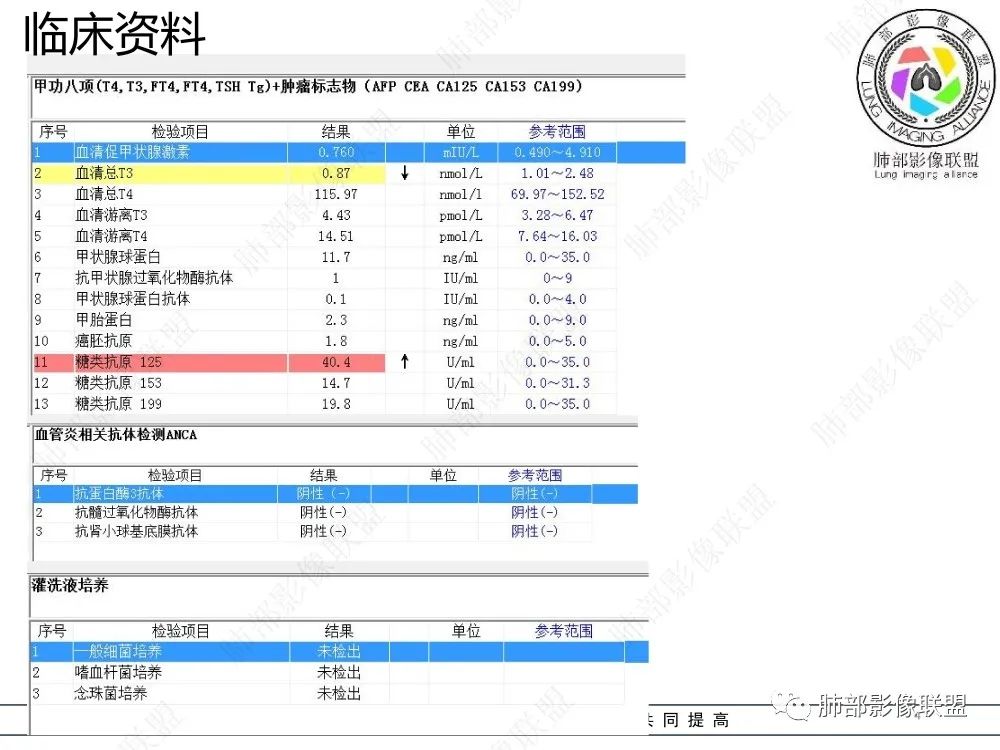 影像PPT - 【病例】以“大片实变影”为表现的粘液表皮样癌-4 影像PPT - 【病例】以“大片实变影”为表现的粘液表皮样癌-4