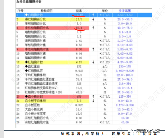 影像PPT - 【病例】以“大片实变影”为表现的粘液表皮样癌-48 影像PPT - 【病例】以“大片实变影”为表现的粘液表皮样癌-48