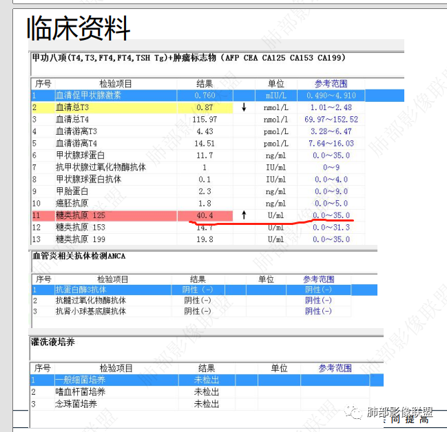 影像PPT - 【病例】以“大片实变影”为表现的粘液表皮样癌-49 影像PPT - 【病例】以“大片实变影”为表现的粘液表皮样癌-49