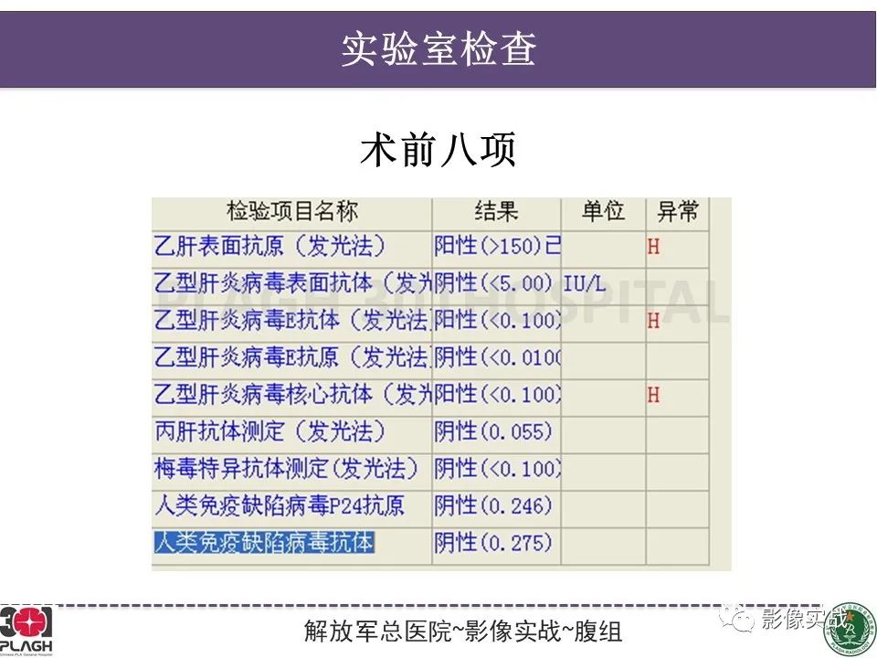影像PPT - 【病例】原发性肝癌伴出血1例MR影像-3