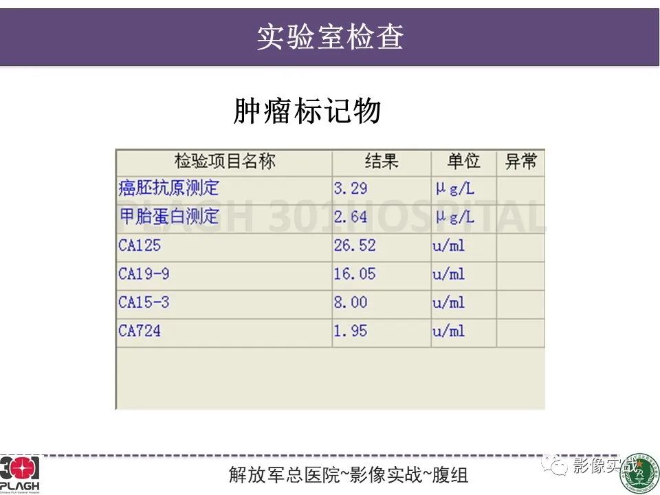 影像PPT - 【病例】原发性肝癌伴出血1例MR影像-4