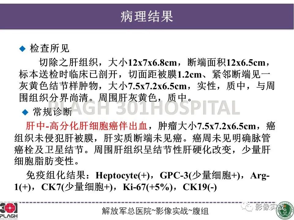 影像PPT - 【病例】原发性肝癌伴出血1例MR影像-23