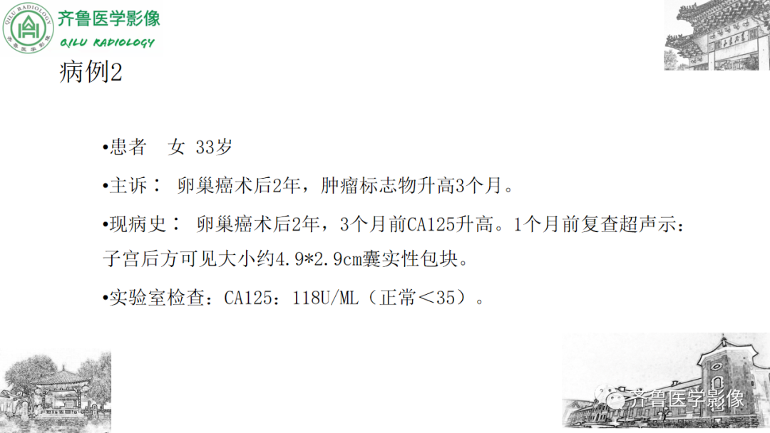 影像PPT - 【病例】卵巢透明细胞癌3例CT及MR影像-7
