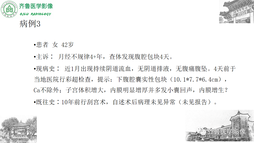 影像PPT - 【病例】卵巢透明细胞癌3例CT及MR影像-13